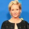 Anne Heche está em coma após acidente de carro em Los Angeles (Reprodução)