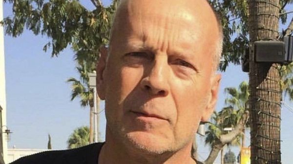 O ator Bruce Willis sofre de uma doença neurológica incurável